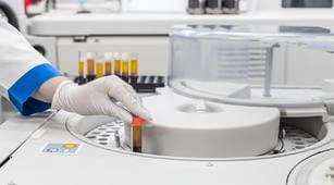 2 Pemeriksaan Laboratorium untuk Mendiagnosis Penyakit Tifus