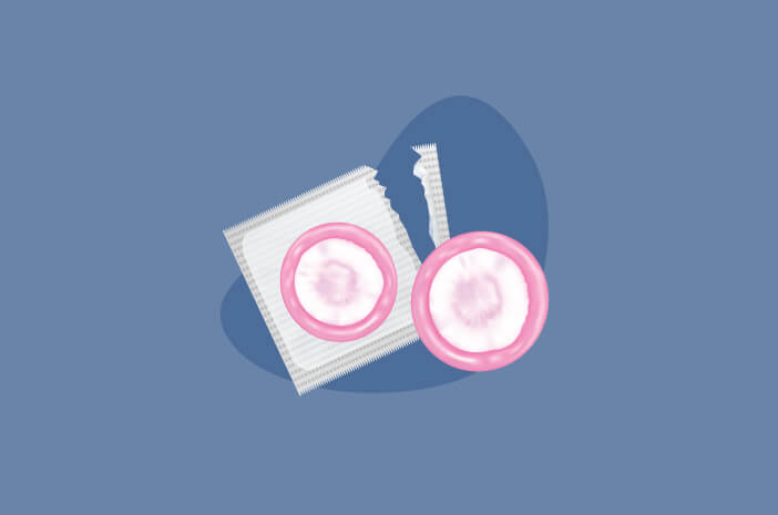 Begini Caranya Cegah Chlamydia karena Hubungan Intim Begini Caranya Cegah Chlamydia karena Hubungan Intim
