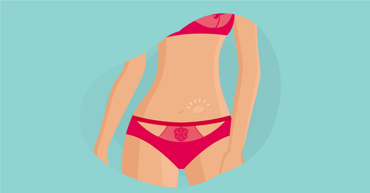 hernia inguinalis, gangguan kesehatan pada usus hernia inguinalis, gangguan kesehatan pada usus