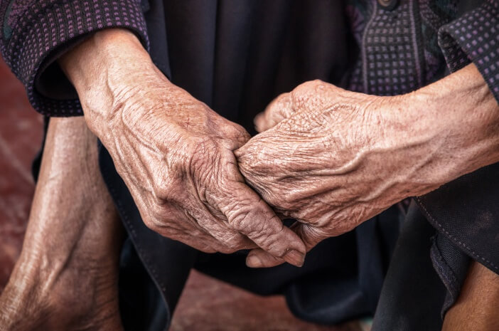 Alami Progeria, Seorang Remaja Terlihat Seperti Nenek-Nenek