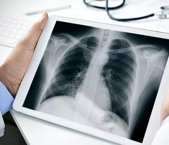 Bisakah X-Ray Sebabkan Efek Samping?