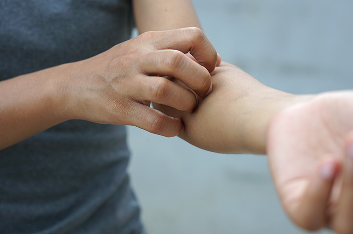 Ketahui Bahaya Eksim pada Pengidap Diabetes