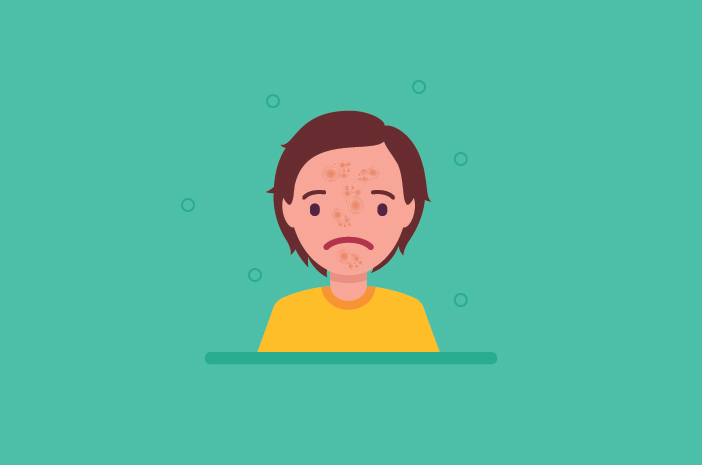 Psoriasis Sering Kambuh, Bisakah Sembuh Sepenuhnya?