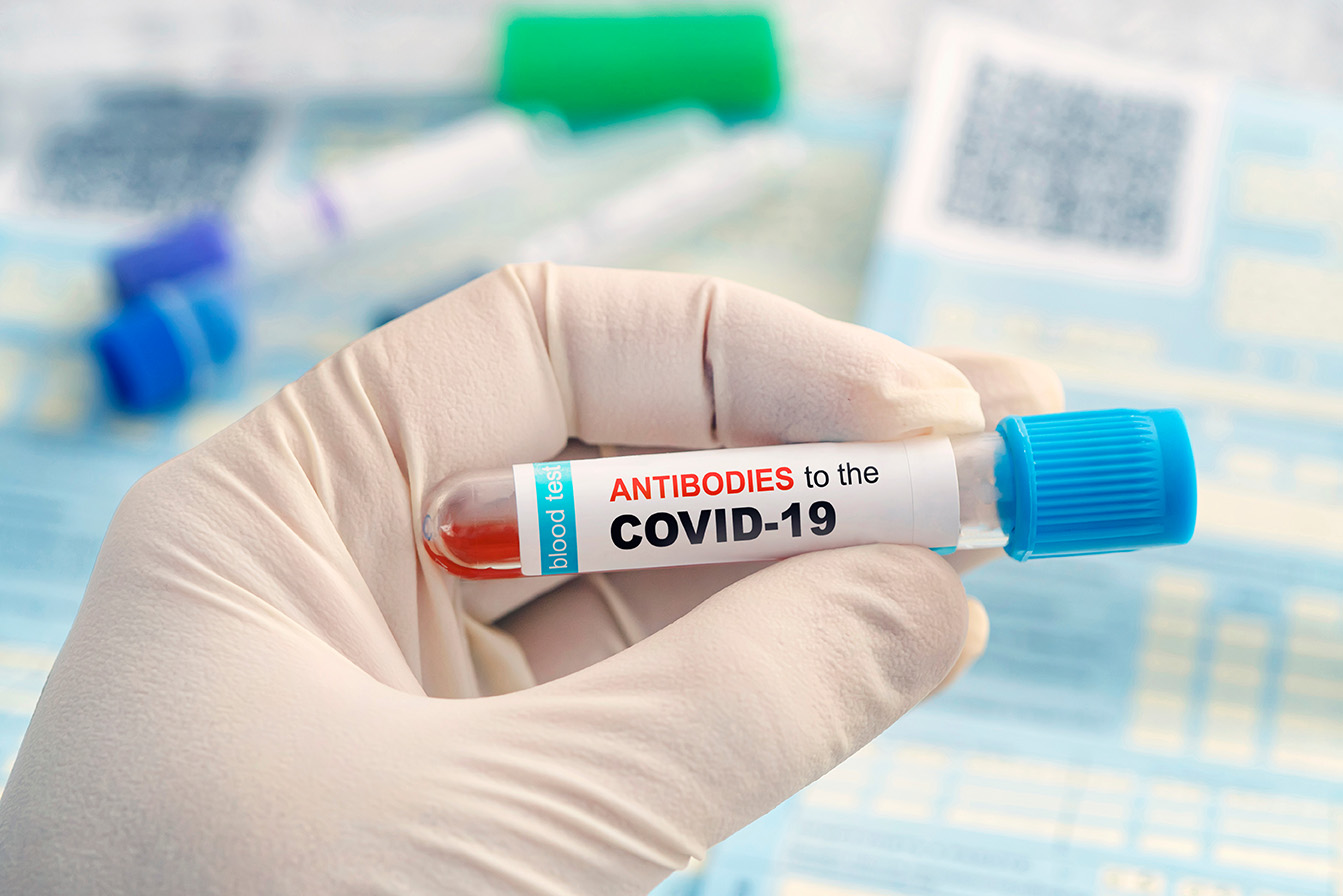 Apakah Cek Antibodi Diperlukan setelah Mendapatkan Vaksin COVID-19?