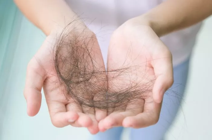 Harus Tahu, 5 Tips Selamatkan Rambut dari Kebotakan