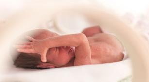 Perlukah Pemasangan Nasogastric Tube untuk Bayi Prematur?
