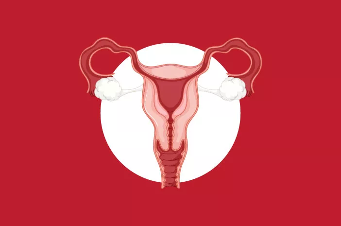 Apa Perbedaan Kista Ovarium dan Endometriosis?