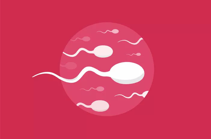 Apakah Penderita Sindrom Klinefelter Bisa Menghasilkan Sperma Subur?