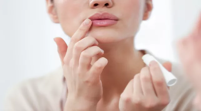 5 Cara Mudah Atasi Bibir Kering, Coba Yuk!