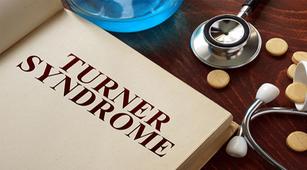Waspadai Komplikasi yang Diakibatkan oleh Sindrom Turner