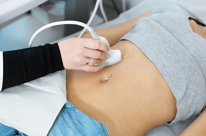 4 Pemeriksaan untuk Mendeteksi Mioma Uteri