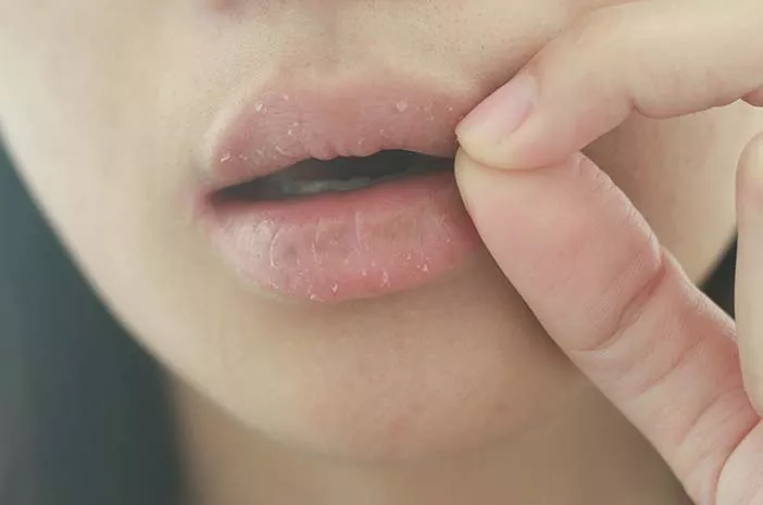 Cara Tepat untuk Merawat Bibir agar Tetap Lembap
