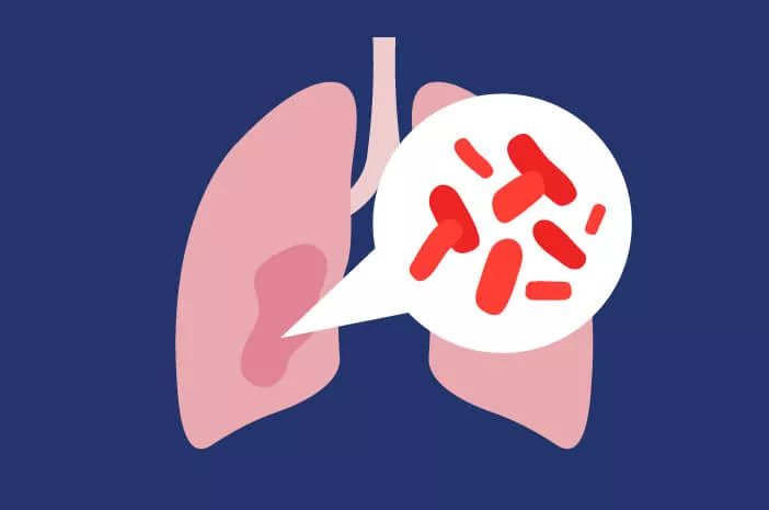Pola Hidup Sehat untuk Atasi Bakteri Pneumonia