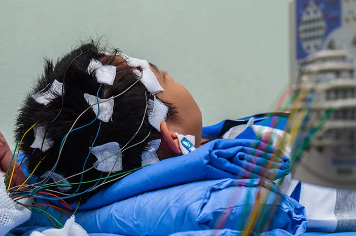 Ketahui Penjelasan Tentang Electroencephalography (EEG)