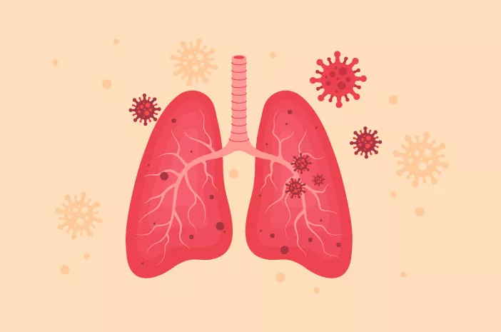 Bisakah Pneumonia Bakterial Disembuhkan Total?