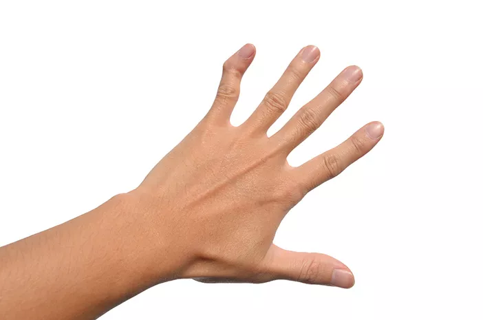 Kapan Tindakan Operasi Diperlukan untuk Mengatasi Mallet Finger?