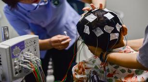 Kecanduan Alkohol Disarankan Lakukan EEG dan Brain Mapping