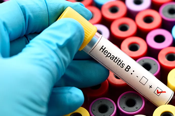 Menular Lewat Cairan Tubuh, Hepatitis B Paling Bahaya?