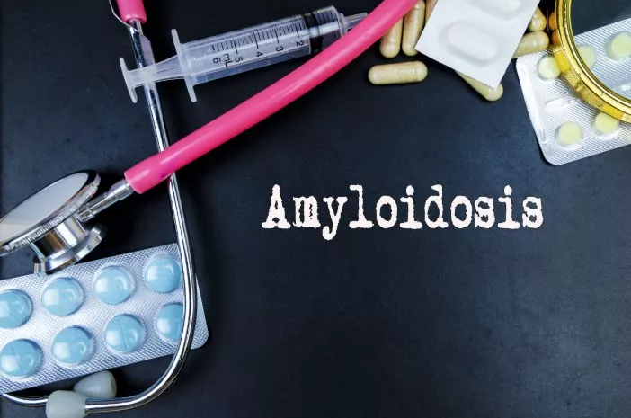 5 Jenis Amiloidosis yang Sebabkan Kerusakan Organ