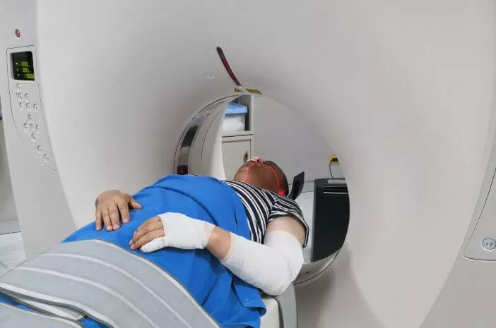 Menjalani Radioterapi Bisa Sebabkan Liposarkoma