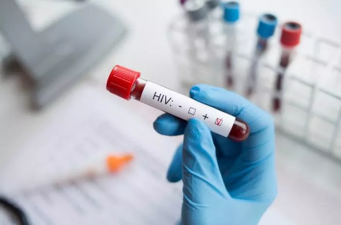 Viral Kasus Vina Garut, Waspadai Gejala HIV pada Pria