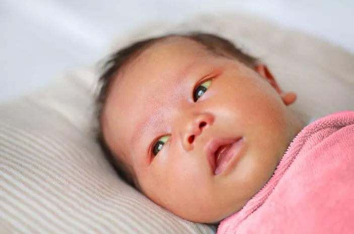 Awas, Bayi Kuning Bisa Sebabkan Kerusakan Otak