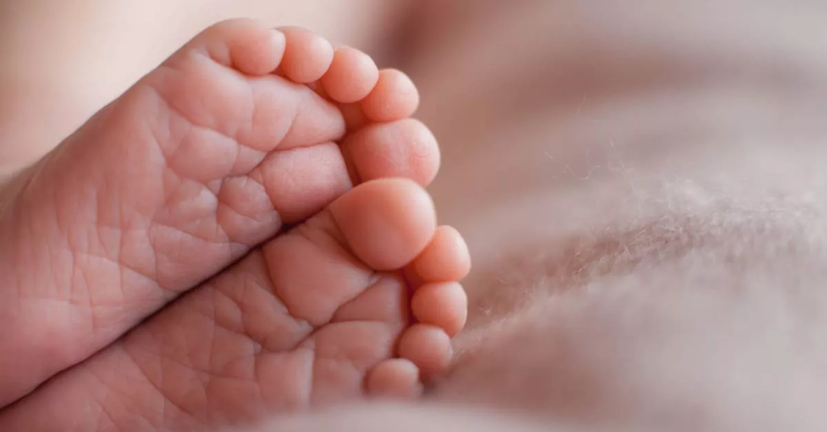 Kenali Jenis-Jenis Pengobatan Clubfoot pada Bayi