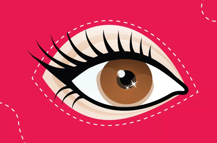 Eyelash Extension Bisa Sebabkan Blefaritis?