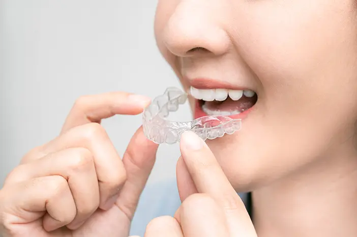 Mitos dan Fakta tentang Retainer Gigi yang Perlu Dipahami
