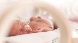 Bagaimana Cara Diagnosis Bayi yang Alami Kernikterus?