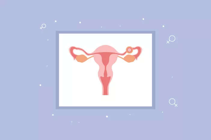 Prosedur Operasi Laparotomi untuk Menangani Kehamilan Ektopik
