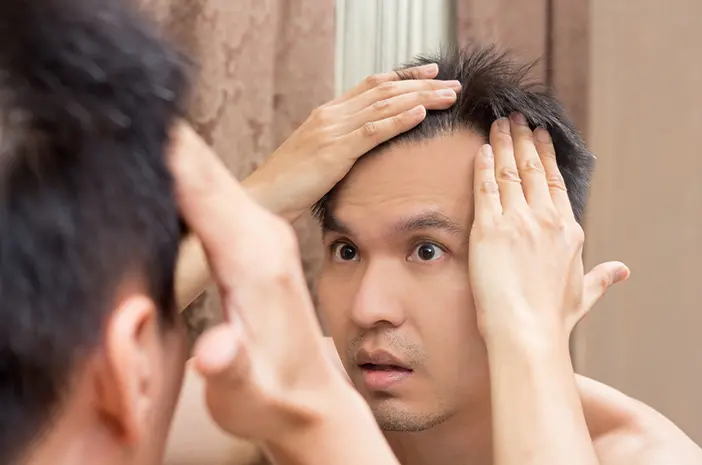 4 Tips Mengatasi Infeksi Kulit Kepala Berdasarkan Penyebabnya