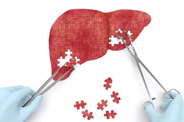 5 Cara Menjaga Kesehatan Liver Supaya Terhindar Hepatomegali