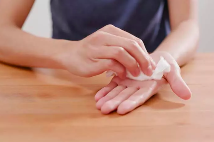 Hiperhidrosis