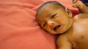 Ketahui Pengobatan Penyakit Kuning pada Bayi yang Baru Lahir