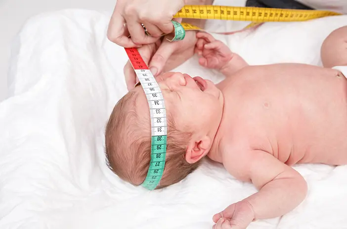 Ketahui 5 Penyebab Kepala Peyang pada Bayi