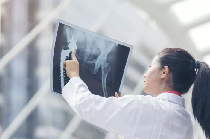 Hal yang Perlu Diperhatikan Sebelum Pemeriksaan X-Ray