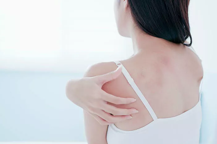 Ketahui Fakta Lengkap Mengenai Dermatitis Atopik