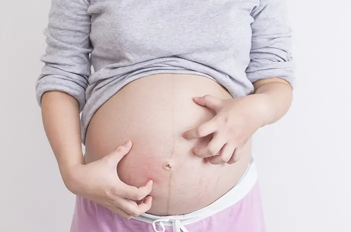 Cara Mengobati Infeksi Kulit yang Terjadi saat Masa Kehamilan