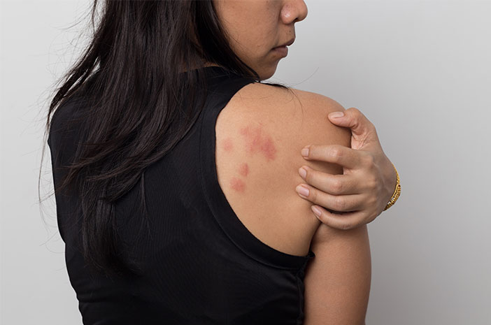 Pemeriksaan Serologi Untuk Deteksi Penyakit Rubella