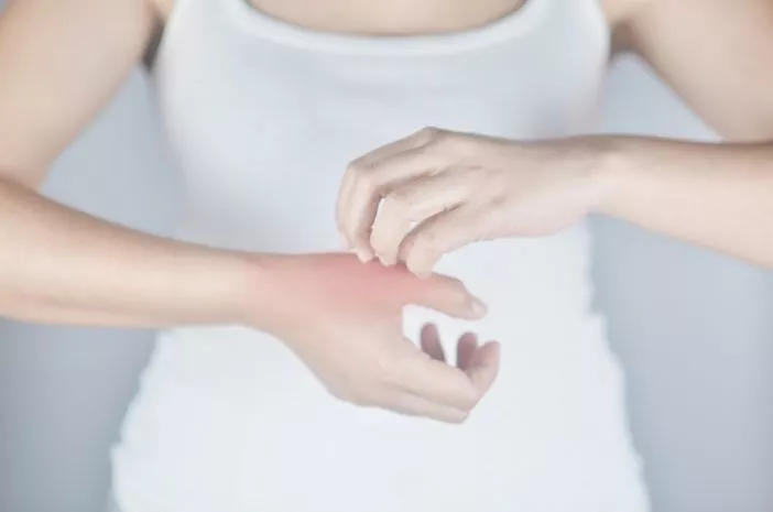 Harus Tahu, 5 Fakta Penting Mengenai Dermatitis Kontak