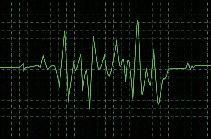 Hampir Mirip, Apa Perbedaan EKG dan EEG?