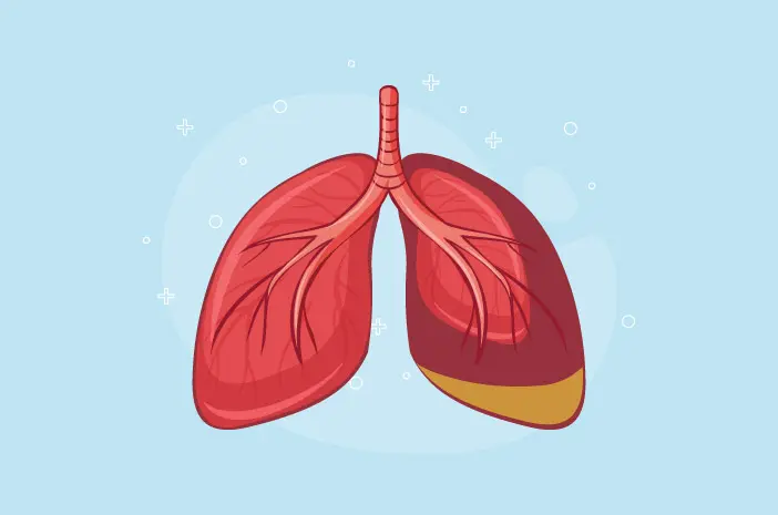 3 Jenis Obat Pneumonia Berdasarkan Penyebabnya