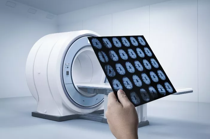 Ketahui Perbedaan dari Prosedur Pemeriksaan MSCT dan MRI