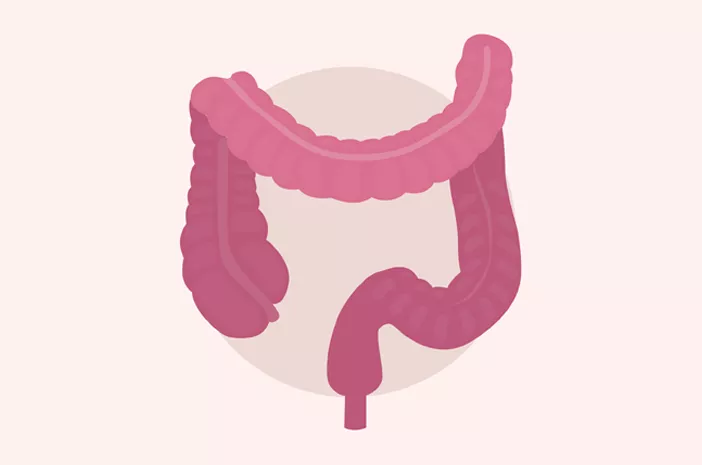 Jaga Kesehatan Usus, Ini Bedanya Radang Usus dan Radang Usus Besar