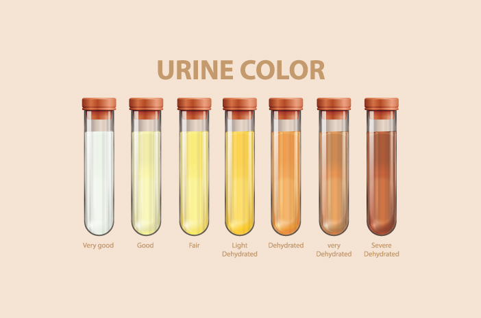 Benarkah Warna Urine Menentukan Kesehatan Ginjal?