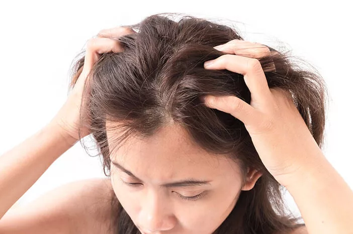 Ini Bahayanya Kutu Rambut yang Tidak Segera Dibasmi 