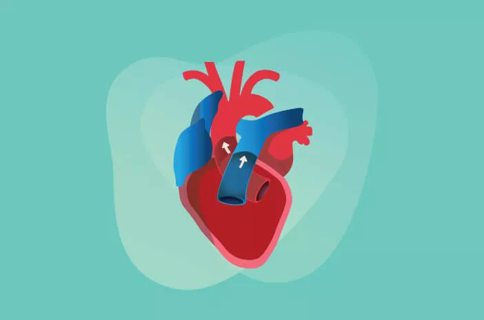 Pengidap Penyakit Katup Jantung Bisakah Sembuh Total?