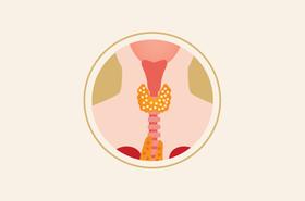 gejala-awal-kanker-tiroid-yang-dapat-terlihat-halodoc