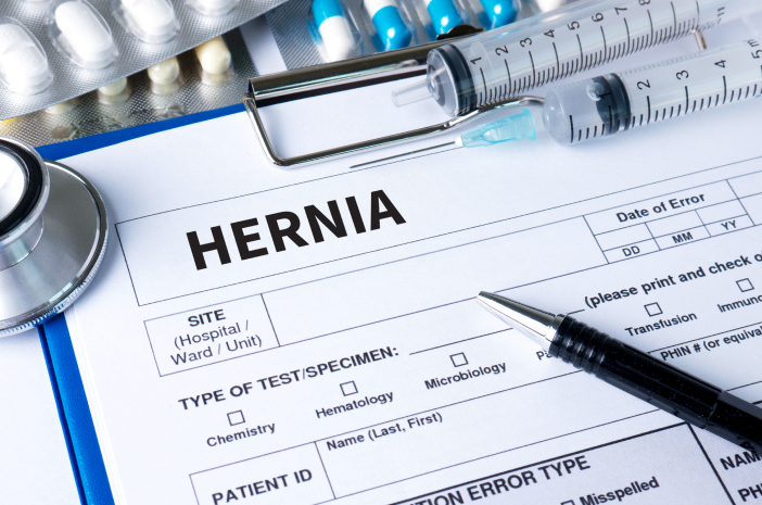 Selain Operasi, Bagaimana Cara Mengobati Hernia?